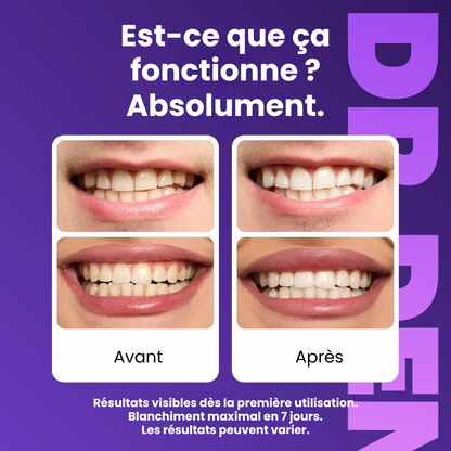 Eulire™ Bandes de blanchiment dentaire violettes