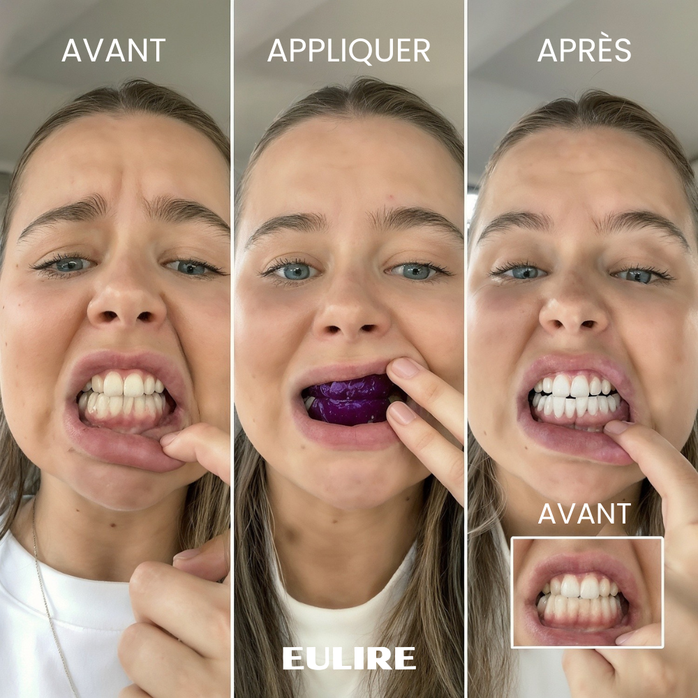 Eulire™ Bandes de blanchiment dentaire violettes